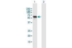 Western Blot analysis of NUP62 expression in transfected 293T cell line by NUP62 MaxPab polyclonal antibody. (NUP62 anticorps  (AA 1-522))
