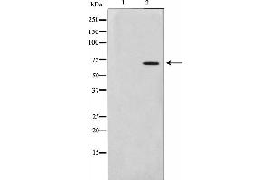 Western blot analysis on HuvEc cell lysate using Involucrin Antibody. (Involucrin anticorps)