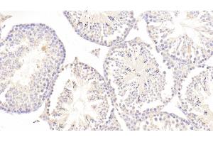 Detection of ERb in Mouse Testis Tissue using Polyclonal Antibody to Estrogen Receptor Beta (ERb) (ESR2 anticorps  (AA 46-530))