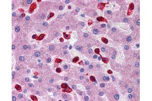 Immunohistochemistry (IHC) image for anti-Peroxiredoxin 2 (PRDX2) (Middle Region) antibody (ABIN2783315)