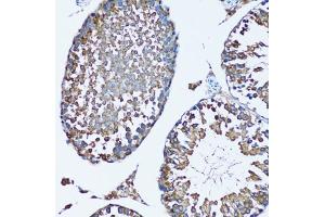 Immunohistochemistry of paraffin-embedded mouse testis using SQS/FDFT1 antibody (ABIN6130393, ABIN6140567, ABIN6140568 and ABIN6221824) at dilution of 1:100 (20x lens). (FDFT1 anticorps  (AA 1-260))