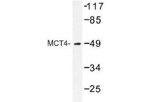Image no. 1 for anti-Solute Carrier Family 16 (Monocarboxylic Acid Transporters), Member 3 (SLC16A3) antibody (ABIN317918) (SLC16A3 anticorps)