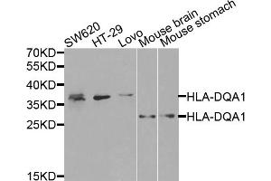 Western blot analysis of extracts of various cell lines, using HLA-DQA1 antibody (ABIN5971195) at 1/1000 dilution. (HLA-DQA1 anticorps)