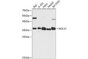 Western blot analysis of extracts of various cell lines using NOL12 Polyclonal Antibody at dilution of 1:3000. (NOL12 anticorps)