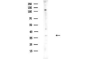 anti-Methionine Adenosyltransferase II, beta (MAT2B) (Internal Region) antibody