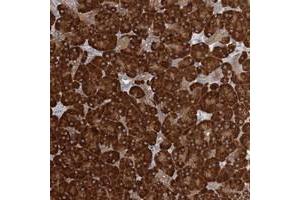 Immunohistochemical staining of human pancreas with FAM110C polyclonal antibody  shows strong cytoplasmic positivity in exocrine glandular cells at 1:200-1:500 dilution. (FAM110C anticorps)