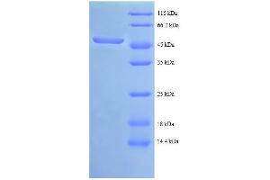 SDS-PAGE (SDS) image for C-Abl Oncogene 1, Non-Receptor tyrosine Kinase (ABL1) (AA 4-194), (partial) protein (GST tag) (ABIN5712349) (ABL1 Protein (AA 4-194, partial) (GST tag))