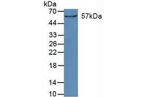 Figure. (CYP27B1 anticorps  (AA 256-508))