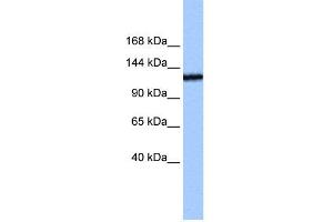 WB Suggested Anti-TEX2 Antibody Titration:  0. (TEX2 anticorps  (N-Term))