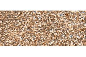 Immunohistochemistry of paraffin-embedded Human tonsil tissue using HOXC12 Polyclonal Antibody at dilution of 1:50(x200) (HOXC12 anticorps)