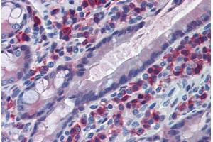 Rat Small Intestine: Formalin-Fixed, Paraffin-Embedded (FFPE) (CD163 anticorps)