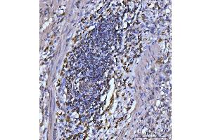 IHC analysis of CD20 using anti-CD20 antibody (ABIN7599180).