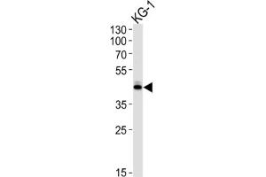 Western Blotting (WB) image for anti-Sirtuin 3 (SIRT3) antibody (ABIN3002564) (SIRT3 anticorps)
