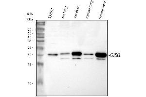 Western blot analysis of GPX1 using anti-GPX1 antibody (ABIN3043834). (Glutathione Peroxidase 1 anticorps  (Middle Region))