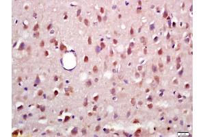 Formalin-fixed and paraffin embedded rat brain labeled with Anti-Phospho-RSK2 (Ser227) Polyclonal Antibody, Unconjugated (ABIN745268) at 1:200 followed by conjugation to the secondary antibody and DAB staining