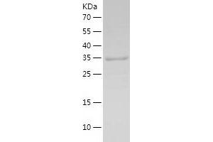 Western Blotting (WB) image for Menage A Trois Homolog 1, Cyclin H Assembly Factor (Xenopus Laevis) (MNAT1) (AA 2-309) protein (His-IF2DI Tag) (ABIN7123911)