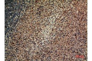 Immunohistochemistry (IHC) analysis of paraffin-embedded Human Spleen, antibody was diluted at 1:100.