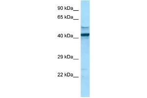 WB Suggested Anti-FCGR1A Antibody Titration: 1.