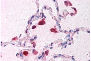 Human Lung (formalin-fixed, paraffin-embedded) stained with IFNB1 antibody ABIN213936 at 5 ug/ml followed by biotinylated goat anti-rabbit IgG secondary antibody ABIN481713, alkaline phosphatase-streptavidin and chromogen. (IFNB1 anticorps  (Internal Region))