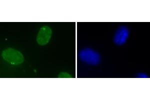 DHX9 antibody (mAb) (Clone 8E3) tested by Immunofluorescence. (DHX9 anticorps  (N-Term))