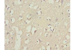 Immunohistochemistry of paraffin-embedded human brain tissue using ABIN7163171 at dilution of 1:100