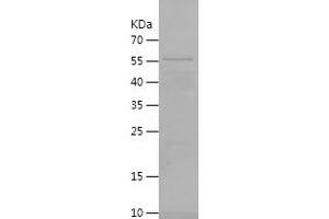 Western Blotting (WB) image for Deoxyribonuclease I-Like 3 (DNASE1L3) (AA 21-305) protein (His-IF2DI Tag) (ABIN7122636)