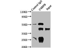 Immunoprecipitating C4BPB in HepG2 whole cell lysate Lane 1: Rabbit control IgG instead of ABIN7146168 in HepG2 whole cell lysate. (C4BPB anticorps  (AA 18-252))