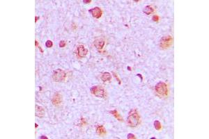 Immunohistochemical analysis of PFKP staining in human brain formalin fixed paraffin embedded tissue section.