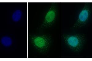 Detection of LSR in Human HepG2 cell using Polyclonal Antibody to Lipolysis Stimulated Lipoprotein Receptor (LSR) (LSR anticorps  (AA 35-205))