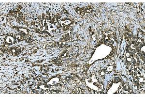 IHC analysis of RAB13 using anti-RAB13 antibody (ABIN7600599). (RAB13 anticorps  (AA 21-200))