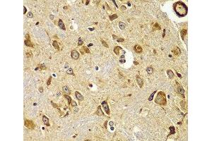 Immunohistochemistry of paraffin-embedded Mouse brain using SMAD9 Polyclonal Antibody at dilution of 1:100 (40x lens). (SMAD9 anticorps)