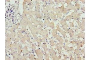 Immunohistochemistry of paraffin-embedded human liver tissue using ABIN7176493 at dilution of 1:100 (ZNF643 anticorps  (AA 15-310))