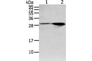 Gel: 12 % SDS-PAGE, Lysate: 40 μg, Lane 1-2: Mouse brain and human fetal brain tissue, Primary antibody: ABIN7128020(SPIN4 Antibody) at dilution 1/200 dilution, Secondary antibody: Goat anti rabbit IgG at 1/8000 dilution, Exposure time: 1 minute (SPIN4 anticorps)
