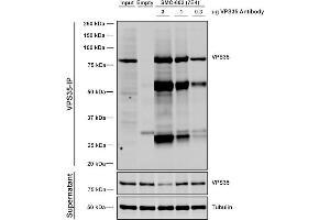 Immunoprecipitation analysis using Mouse Anti-VPS35 Monoclonal Antibody, Clone 7E4 (ABIN6932912). (VPS35 anticorps  (Atto 594))