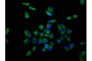 Immunofluorescence staining of Hela cells with ABIN7161665 at 1:200, counter-stained with DAPI. (OPRL1 anticorps  (AA 323-370))