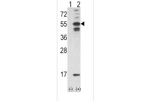 Western blot analysis of CAMK2A using rabbit polyclonal C using 293 cell lysates (2 ug/lane) either nontransfected (Lane 1) or transiently transfected with the CAMK2A gene (Lane 2). (CAMK2A anticorps  (C-Term))