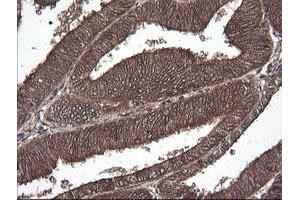 Image no. 2 for anti-Cancer/testis Antigen 1B (CTAG1B) antibody (ABIN1499906) (CTAG1B anticorps)
