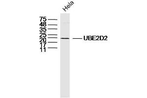 Hela lysates probed with UBE2D2 Polyclonal Antibody, Unconjugated  at 1:300 dilution and 4˚C overnight incubation. (UBE2D2 anticorps  (AA 31-130))