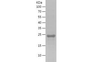 Western Blotting (WB) image for Spermatogenesis Associated 22 (SPATA22) (AA 1-200) protein (His tag) (ABIN7125188)