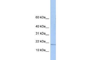 Human Placenta; WB Suggested Anti-ZNHIT3 Antibody Titration: 0. (ZNHIT3 anticorps  (N-Term))