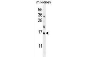 Western Blotting (WB) image for anti-Harakiri, BCL2 Interacting Protein (Contains Only BH3 Domain) (HRK) (BH3 Domain) antibody (ABIN2997154)