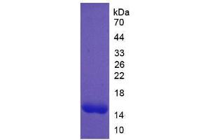 Image no. 1 for Platelet Derived Growth Factor A (PDGFA) (AA 90-190) protein (His tag) (ABIN6236661) (PDGFA Protein (AA 90-190) (His tag))
