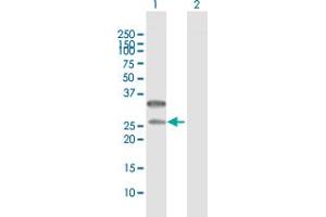 Western Blot analysis of CD79B expression in transfected 293T cell line by CD79B MaxPab polyclonal antibody. (CD79b anticorps  (AA 1-229))