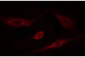 ABIN6274811 staining NIH-3T3 cells by IF/ICC. (ADAMTS18 anticorps  (C-Term))