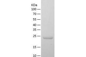 Western Blotting (WB) image for General Transcription Factor IIIC, Polypeptide 6, alpha 35kDa (GTF3C6) (AA 1-213) protein (His-IF2DI Tag) (ABIN7123077)