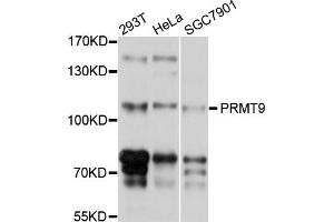 Western blot analysis of extracts of various cell lines, using PRMT9 antibody (ABIN4904870) at 1:1000 dilution.