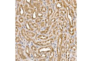 Immunohistochemistry of paraffin-embedded rat kidney using ACLY Rabbit pAb (ABIN7265716) at dilution of 1:150 (40x lens).