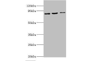 Western blot All lanes: SATB1 antibody at 2 μg/mL Lane 1: Mouse brain tissue Lane 2: 293T whole cell lysate Lane 3: Jurkat whole cell lysate Secondary Goat polyclonal to rabbit IgG at 1/10000 dilution Predicted band size: 86, 90 kDa Observed band size: 86 kDa (SATB1 anticorps  (AA 484-763))