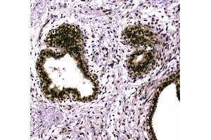 IHC analysis of SAE2/UBA2 using anti-SAE2/UBA2 antibody . (UBA2 anticorps  (AA 449-564))