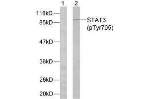 Western blot analysis of extracts from HeLa cells using STAT3 (phospho-Tyr705) antibody (E011045). (STAT3 anticorps  (pTyr705))